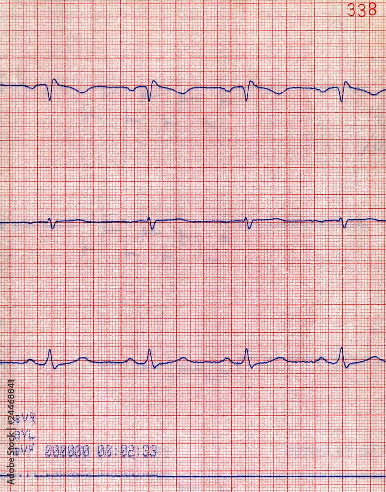 cardio signal patient diagram, clinic health care, cardiology diversity cardio signal patient diagram, clinic health care, cardiology diversity