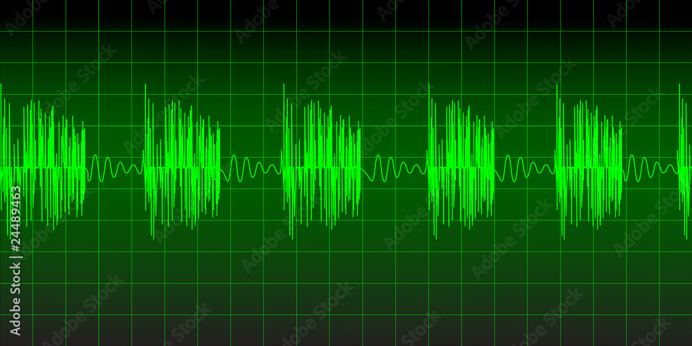 equalizer equalizer