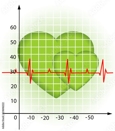 Diagram of the heartbeat