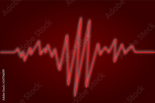 EKG rot