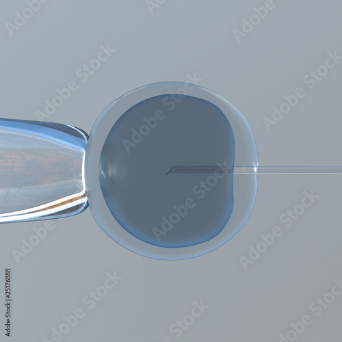 in vitro fertilization