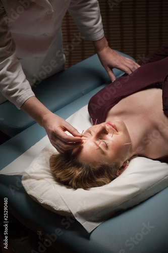 Acupuncture patient
