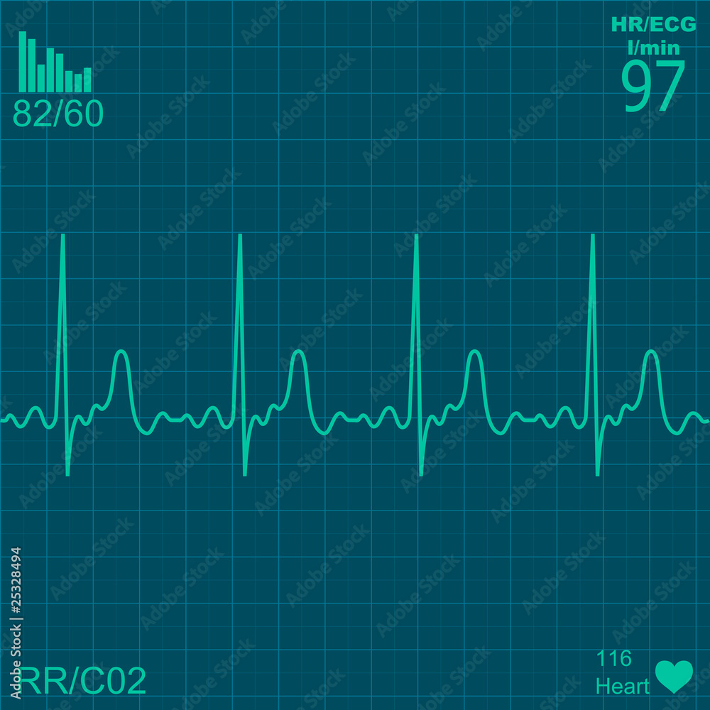 Illustration of electrical activity of the human heart Illustration of electrical activity of the human heart