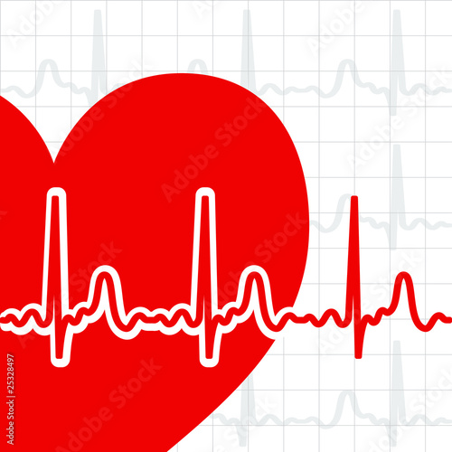 Heart cardiogram