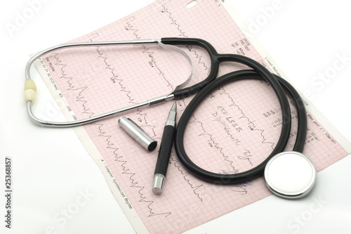 phonendoscope lying on a cardiogram