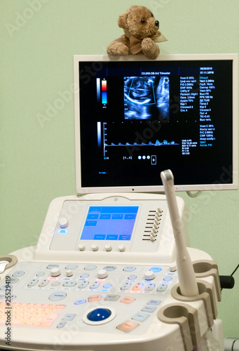 Medical Equipment ultrasound scanning. Diagnosis of pregnancy.