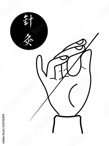 acupuncture of traditional Chinese medical science
