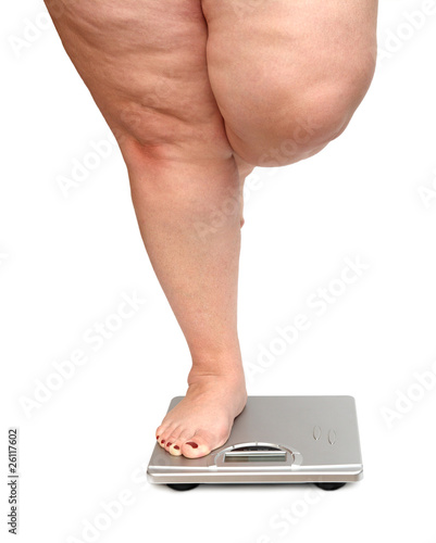 women legs with overweight