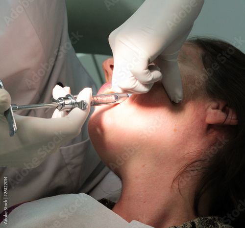 anesthésie dentaire photo