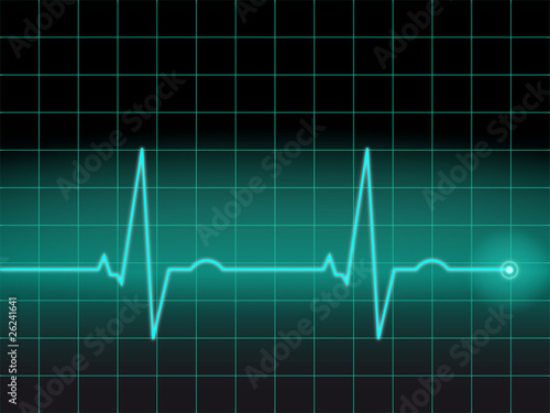 Clean EKG