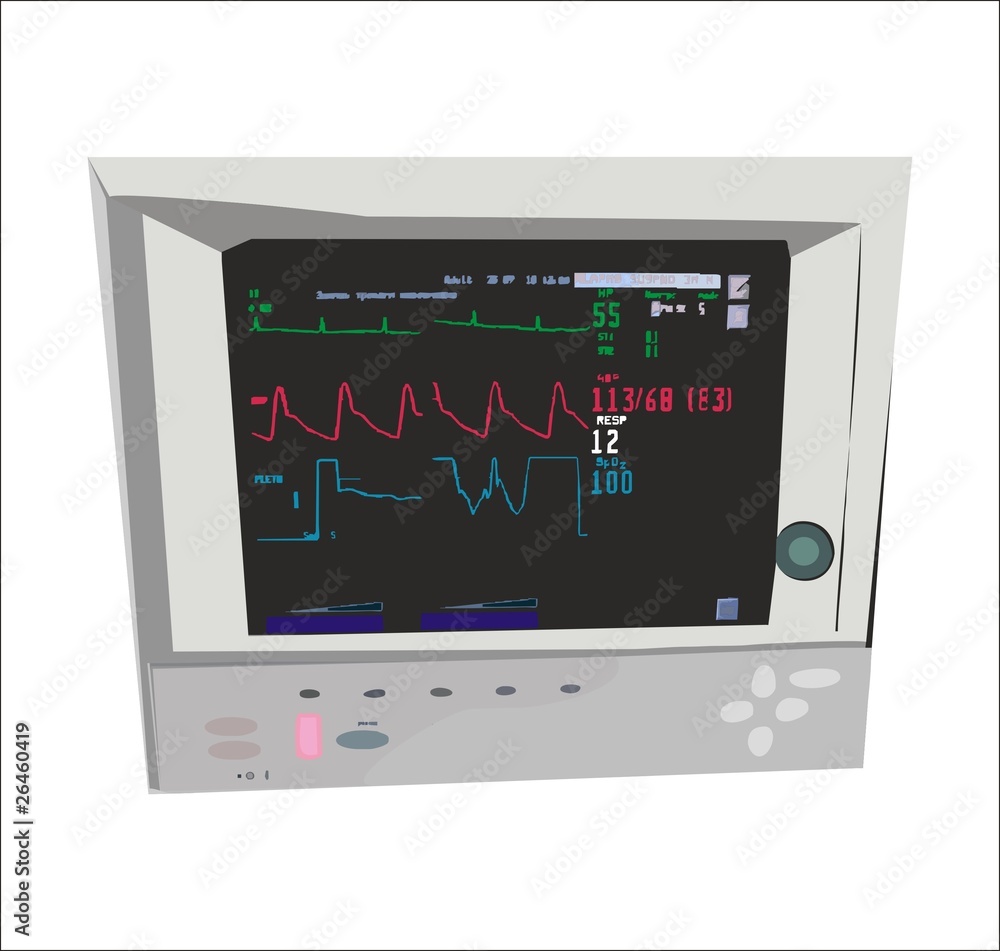 Cardiomonitor in work