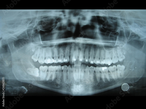 Panoramic dental radiology slide