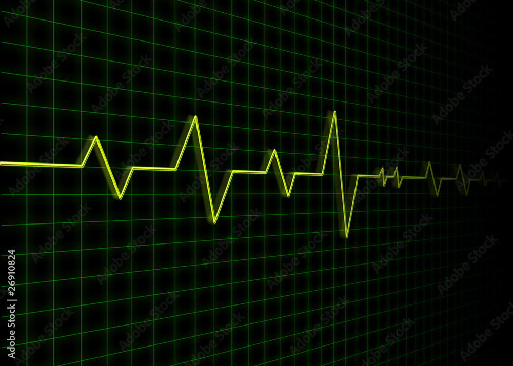 Electrocardiogram Electrocardiogram
