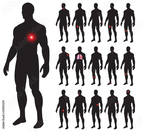 Set of illness people with pain dots. Vector illustration.