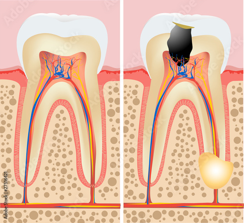 Tooth