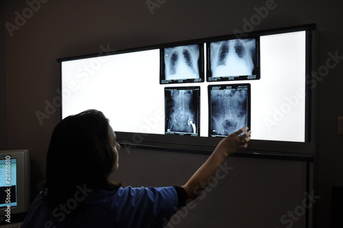 Radio - Scanner - Imagerie médicale