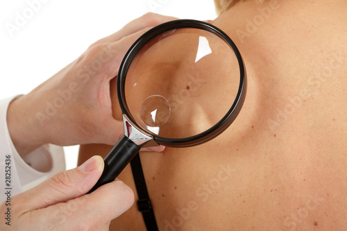 Hautarzt untersucht ein Muttermal