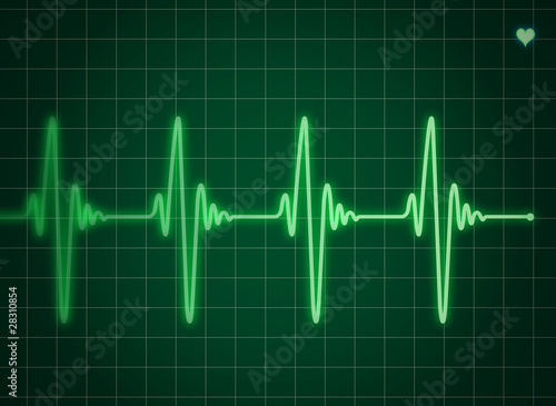 Électrocardiogramme vert