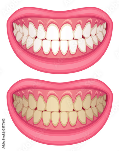 Mouth