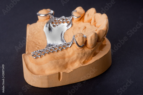 dental wax model