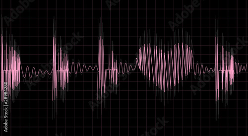 Heartbeat