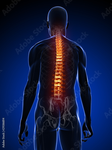 menschliche Anatomie - Rückenschmerzen