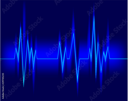 Electrocardiogram