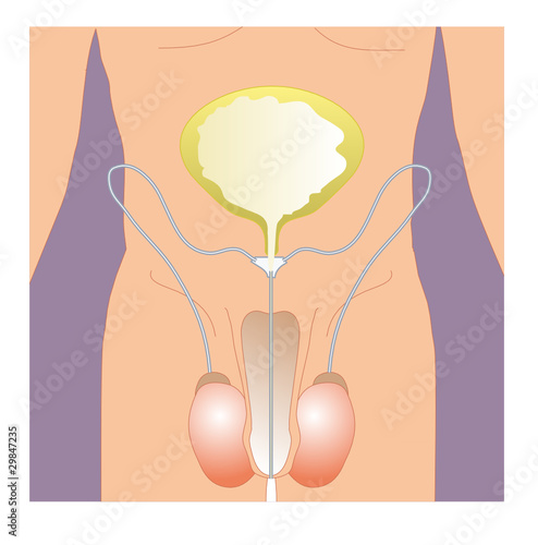Urogenital männlich vergrößert