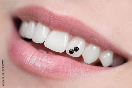 Close-up of open mouth with dental jewelry tooth photo