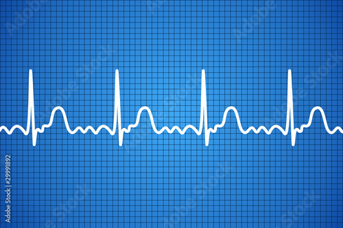 Cardiogramme