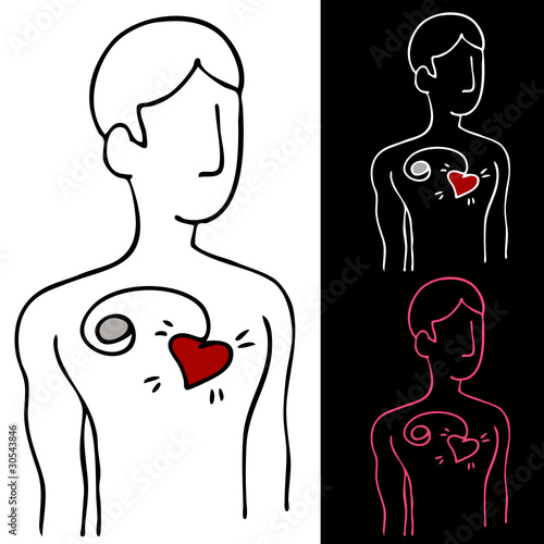 Pacemaker