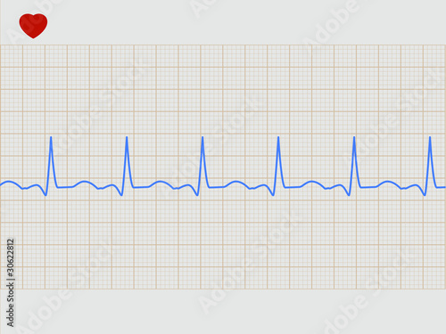 Normal electronic cardiogram. EPS 8