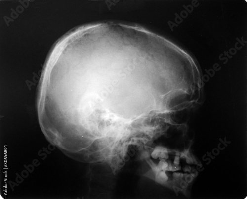 detail of neck and head x-ray