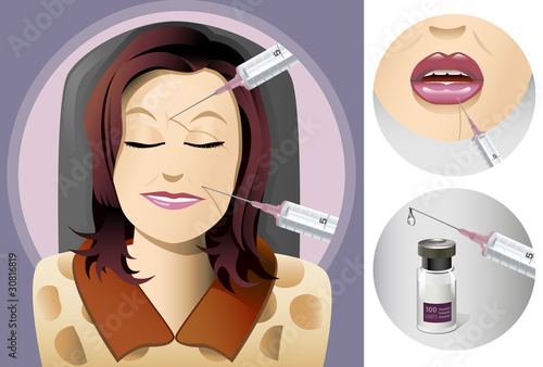 Botox treatment to face, closeup of lips and syringe