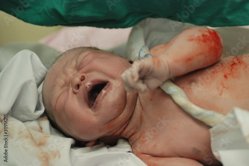 new born infant in the operation room