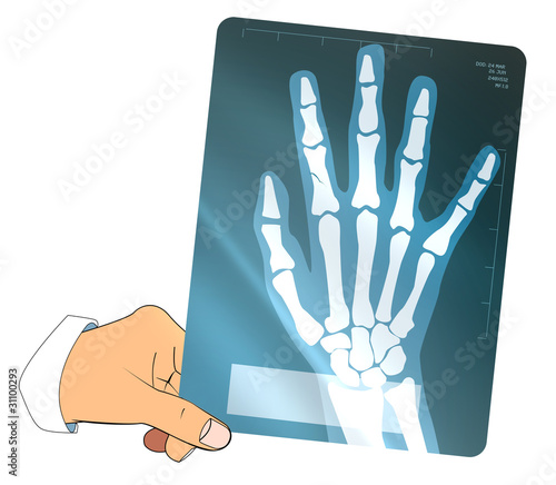 mano xray