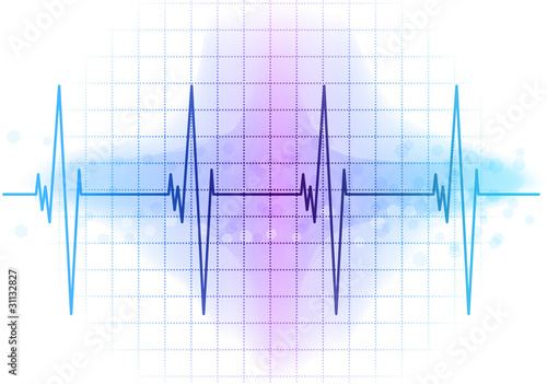 ekg diagram
