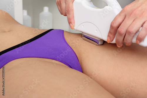 Laser hair removal within part of bikini