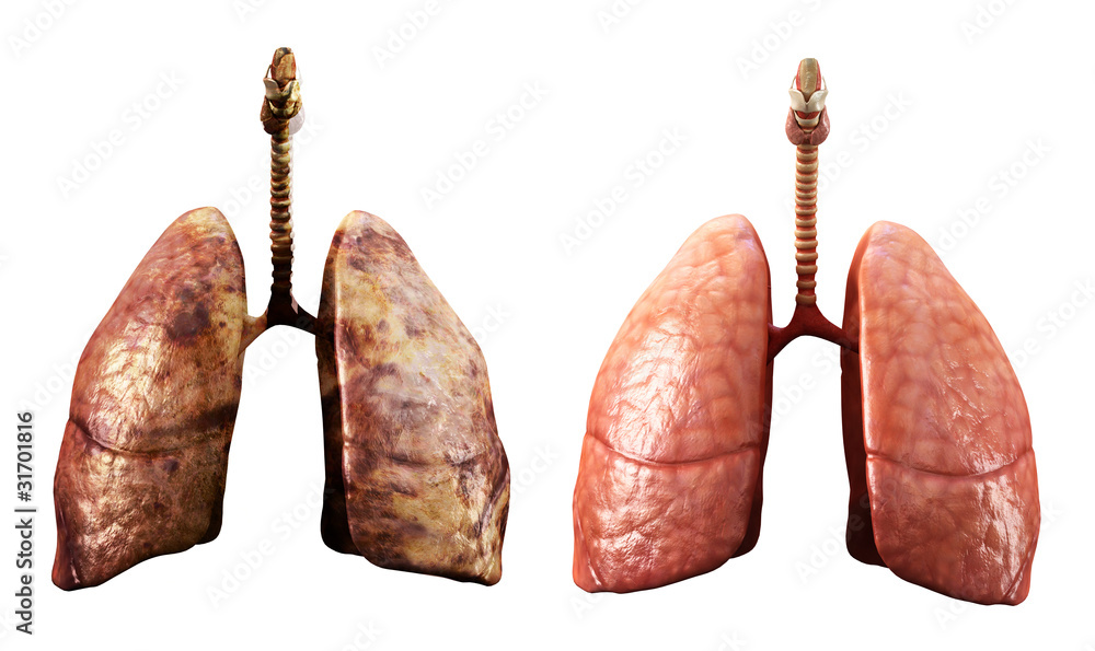 healthy and rotten lungs Stock Illustration Adobe Stock