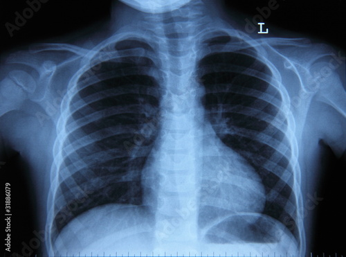 Pulmonary Radiography