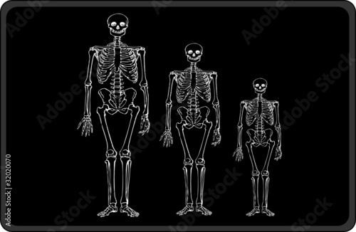 Black - Anatomie