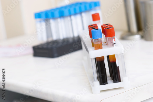 Test tubes with blood photo