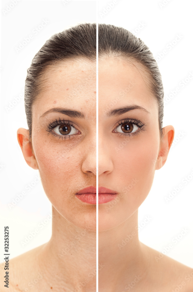 Naklejka premium beauty concept before and after retouch