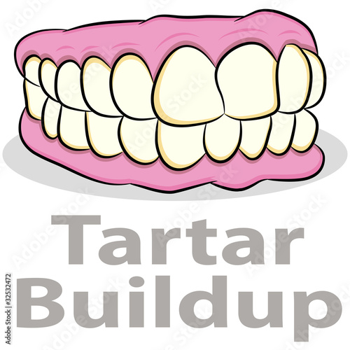 Tartar Buildup on Teeth