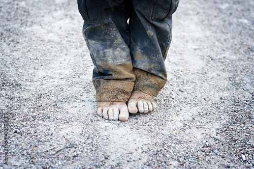 child's dirty feet. poorness concept