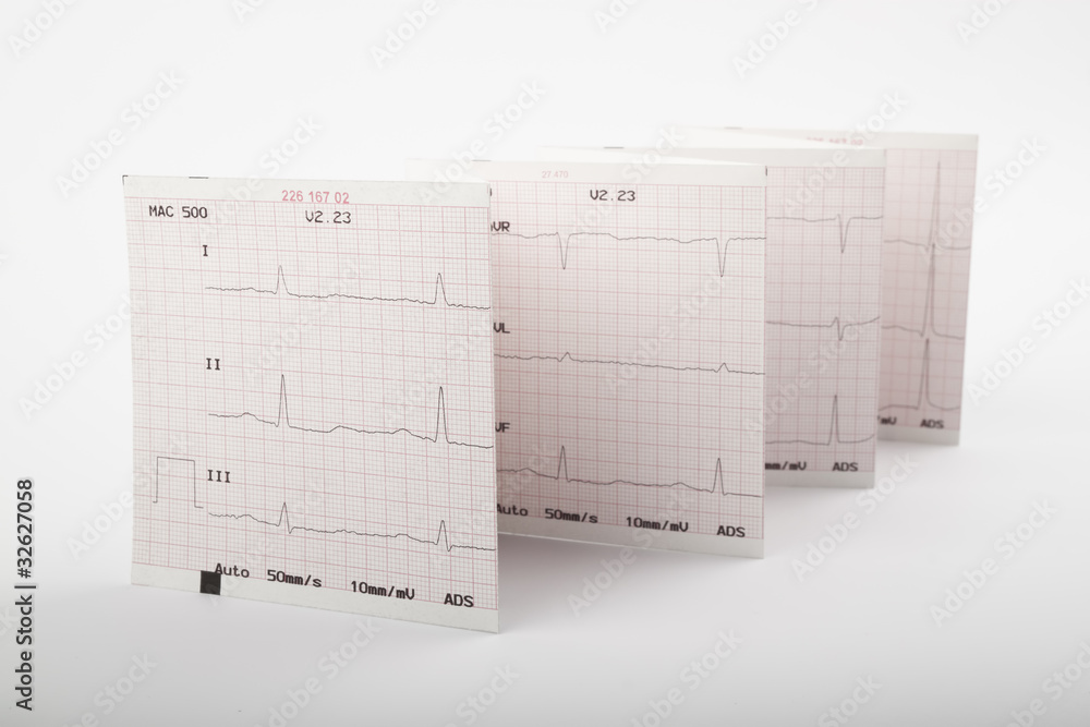 Obraz premium cardiogram