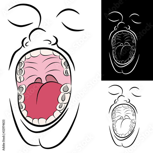 Mouth with Metal Dental Fillings