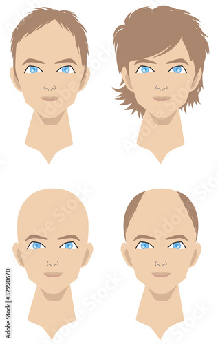 薄毛になる男性