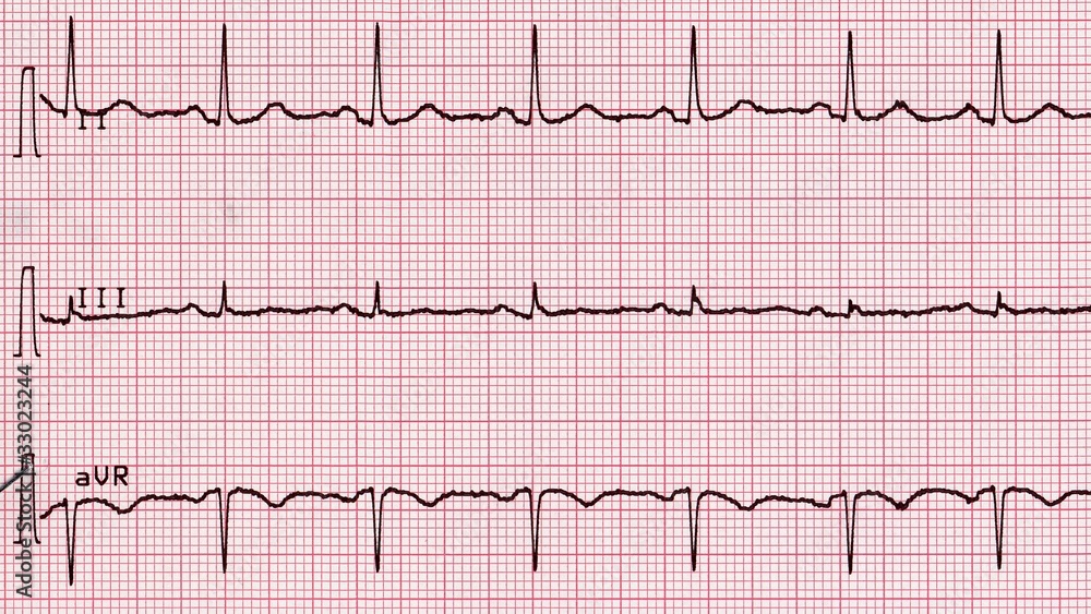 Naklejka premium Electrocardiography of heart beat