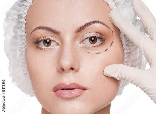 Correction lines on woman face  before surgery operetion